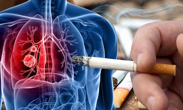 विश्व धूम्रपान निषेध दिवस: तम्बाकू का ‘मजा’, मौत की ‘सजा’